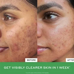 Ole Henriksen Renseprodukter<BALANCE Daily D-Clog Pore-Clearing Cleanser