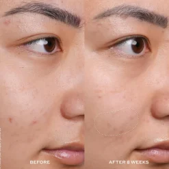 Ole Henriksen Anti-Age|Serum<Banana Bright Vitamin C Serum