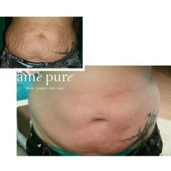âme pure Body Basic - Stretch Marks<Børn Hudpleje Til Gravid Og Nybagt Mor|Hudpleje Til Gravid Og Nybagt Mor