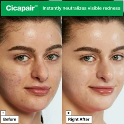 Dr.Jart+ Dagcreme>Cicapair Tiger Grass Color Correcting Treatment