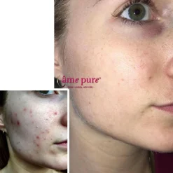 âme pure CIT Face Roller Platinum Kit< Ansigtsbehandling