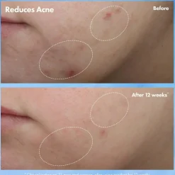 Origins Clear Improvement Acne & Blackhead Clearing Hydrating Moisturizer Lotion< Natcreme