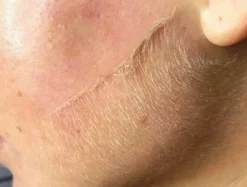 Melle. Dermaplane Razor< Øjenbrynstrimmere|Skrabere & Blade