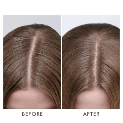 Moroccanoil Hovedbundspleje|Rejsestørrelser<Dry Scalp Treatment