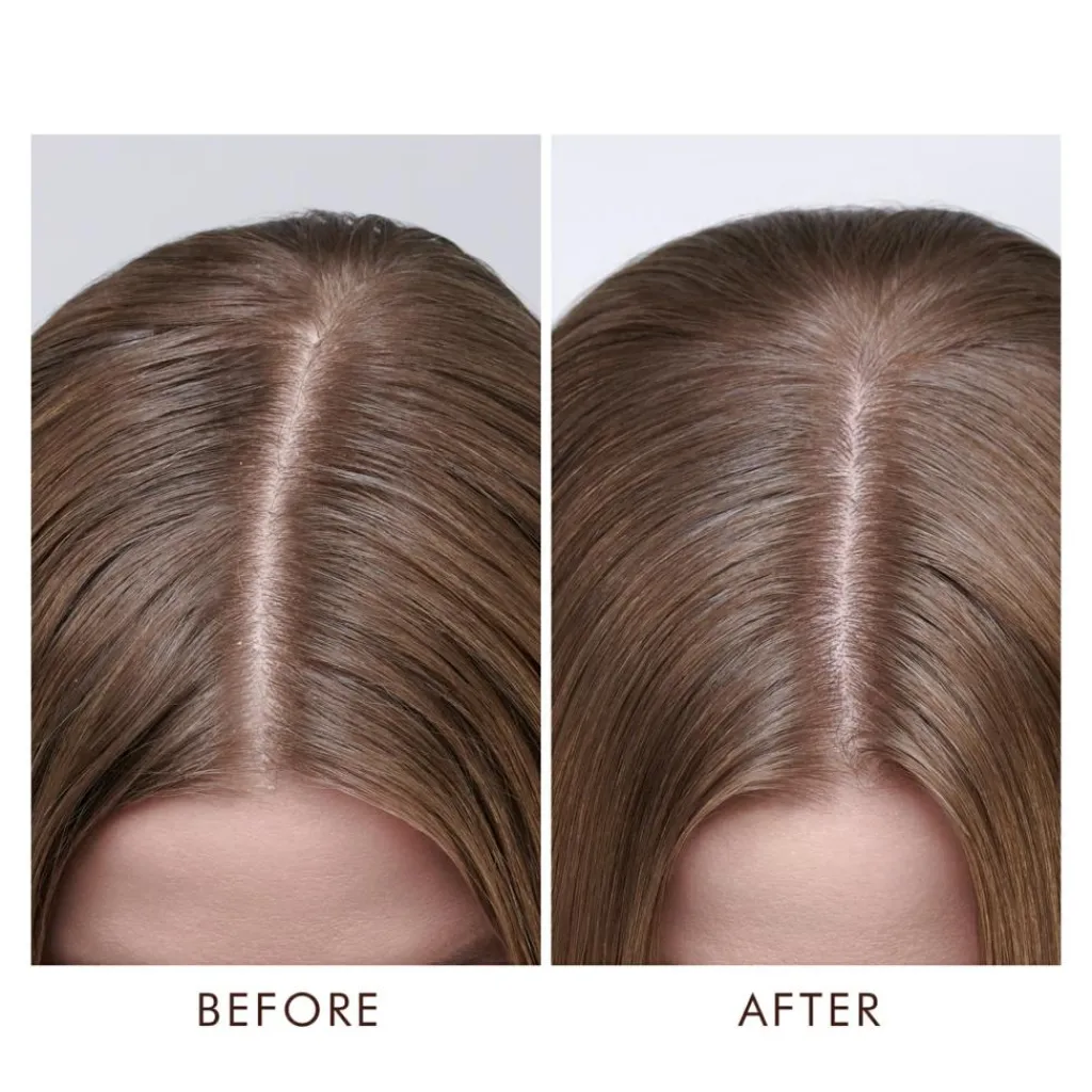 Moroccanoil Hovedbundspleje|Rejsestørrelser<Dry Scalp Treatment