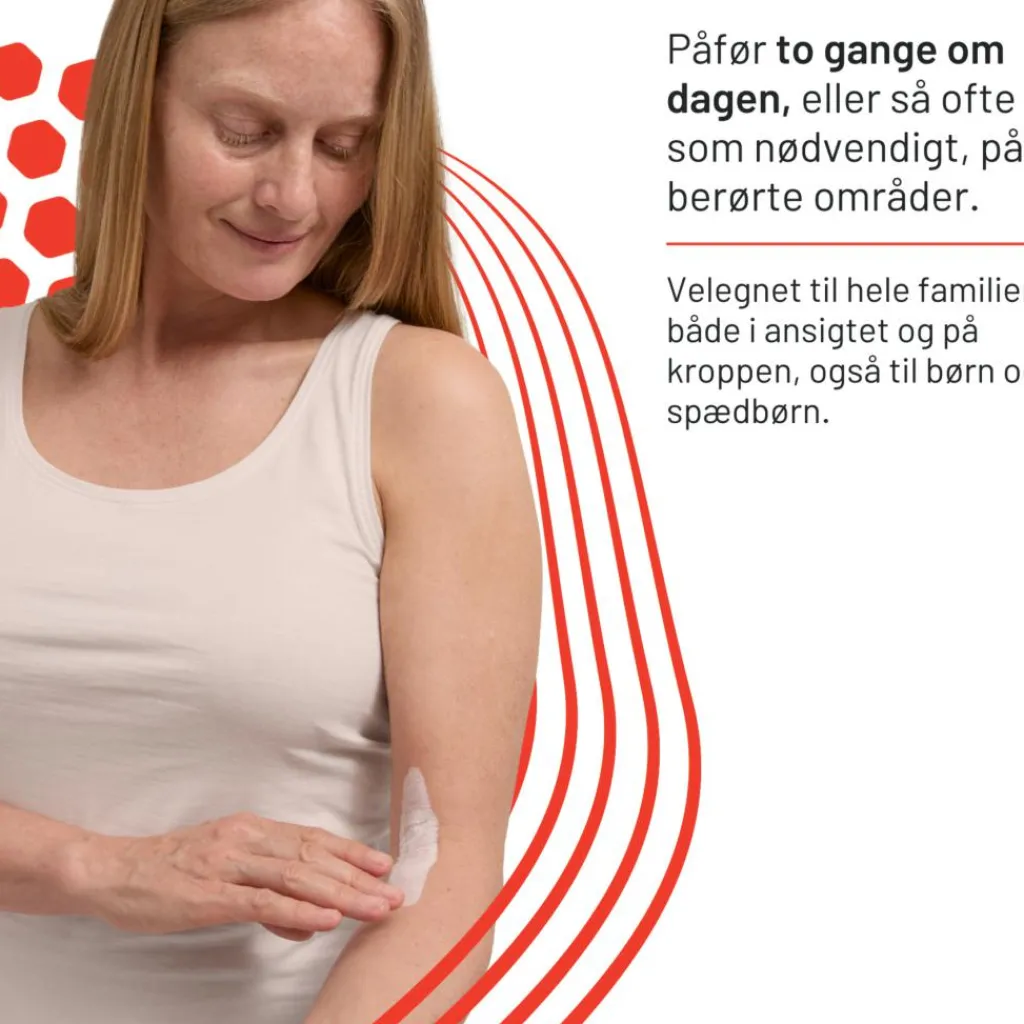 Locobase Eksem & Tør Hud|Kropspleje>Eczema Cream