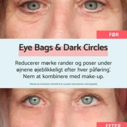 Remescar Øjenpleje<Eye bags & Dark Circles