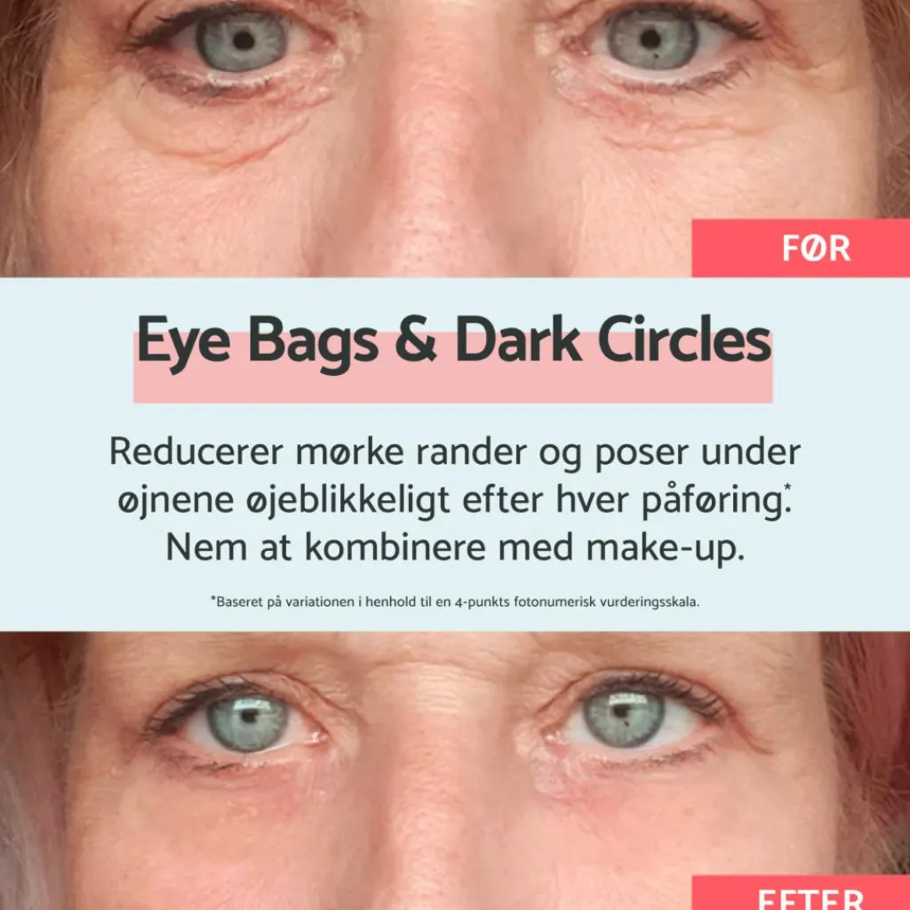 Remescar Øjenpleje<Eye bags & Dark Circles