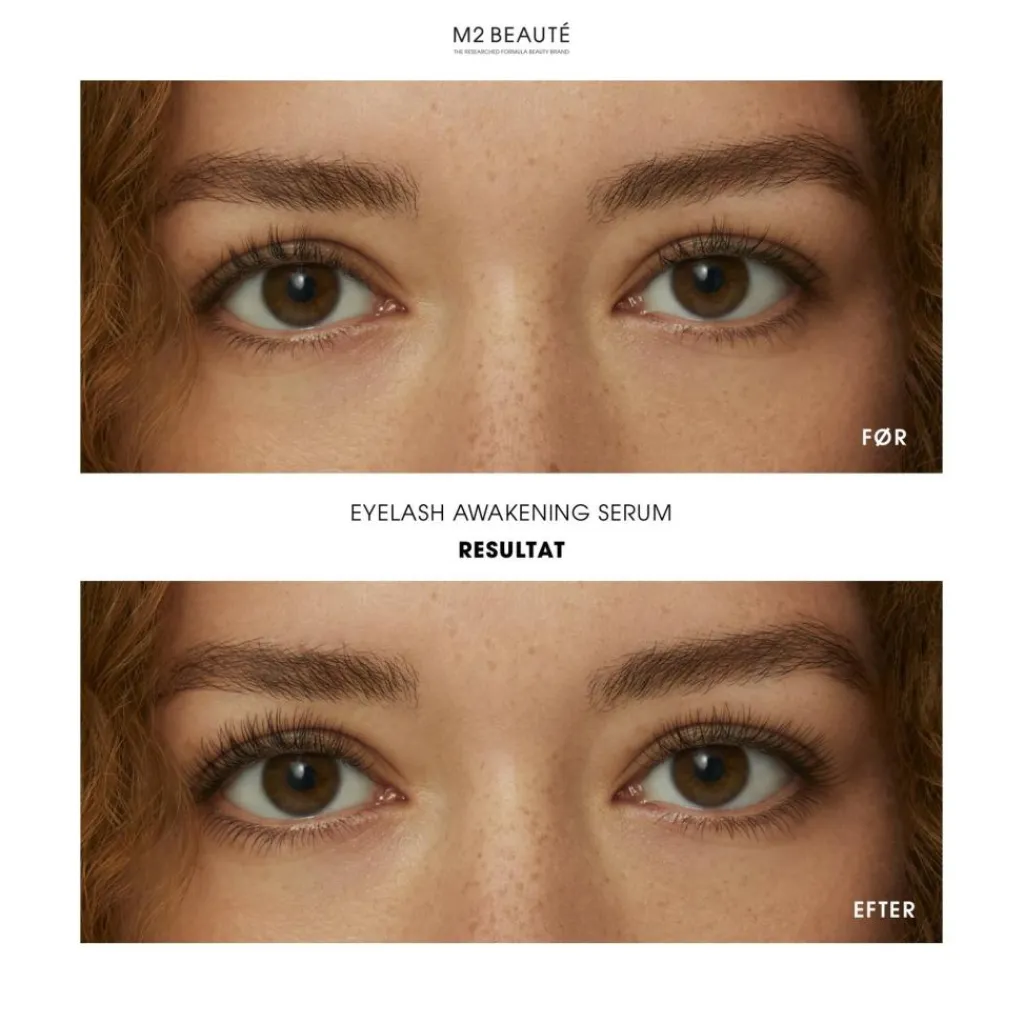 M2 Beauté Eyelash Awakening Serum< Øjenvipper