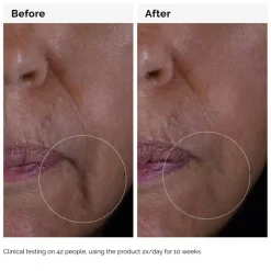 The Ordinary Serum<GF 15% Solution Serum