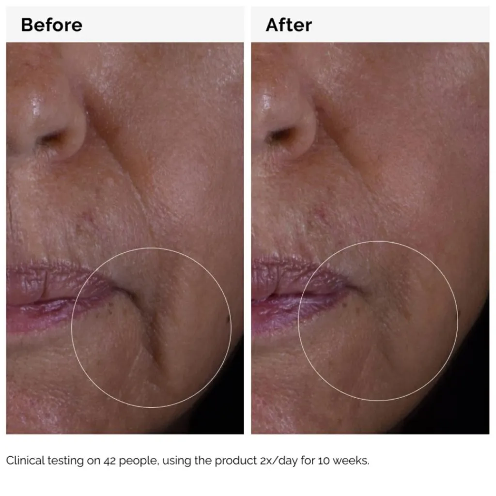The Ordinary Serum<GF 15% Solution Serum
