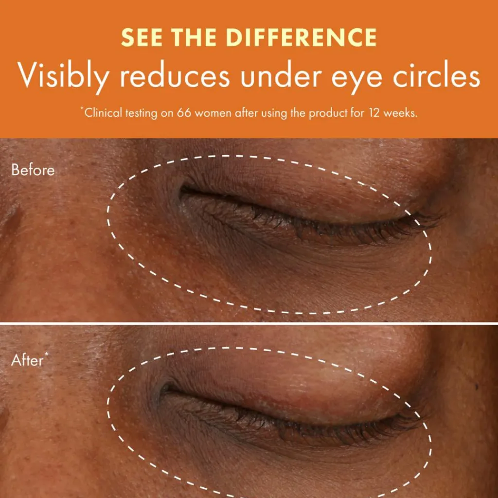Origins Øjenpleje>Ginzing Brightening Eye Cream