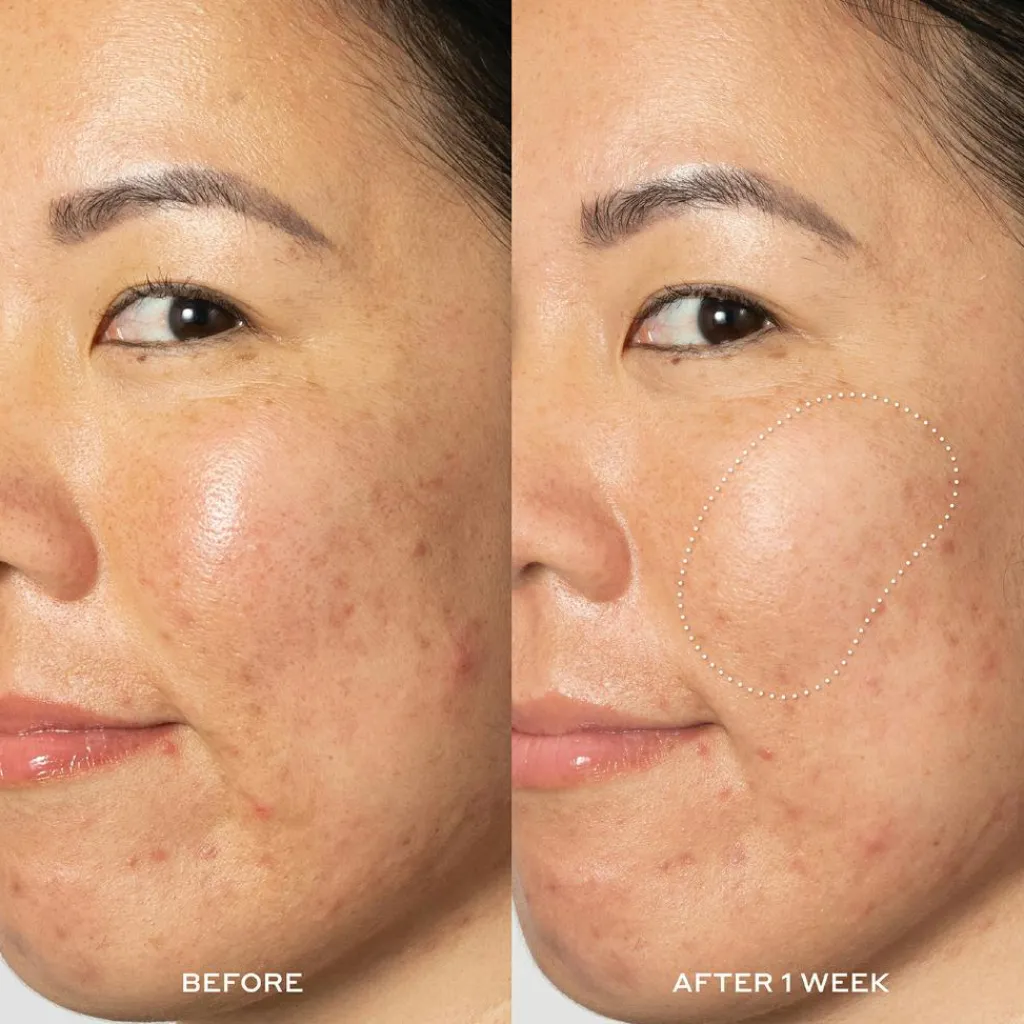 Ole Henriksen Renseprodukter<Glow2OH Dark Spot Toner