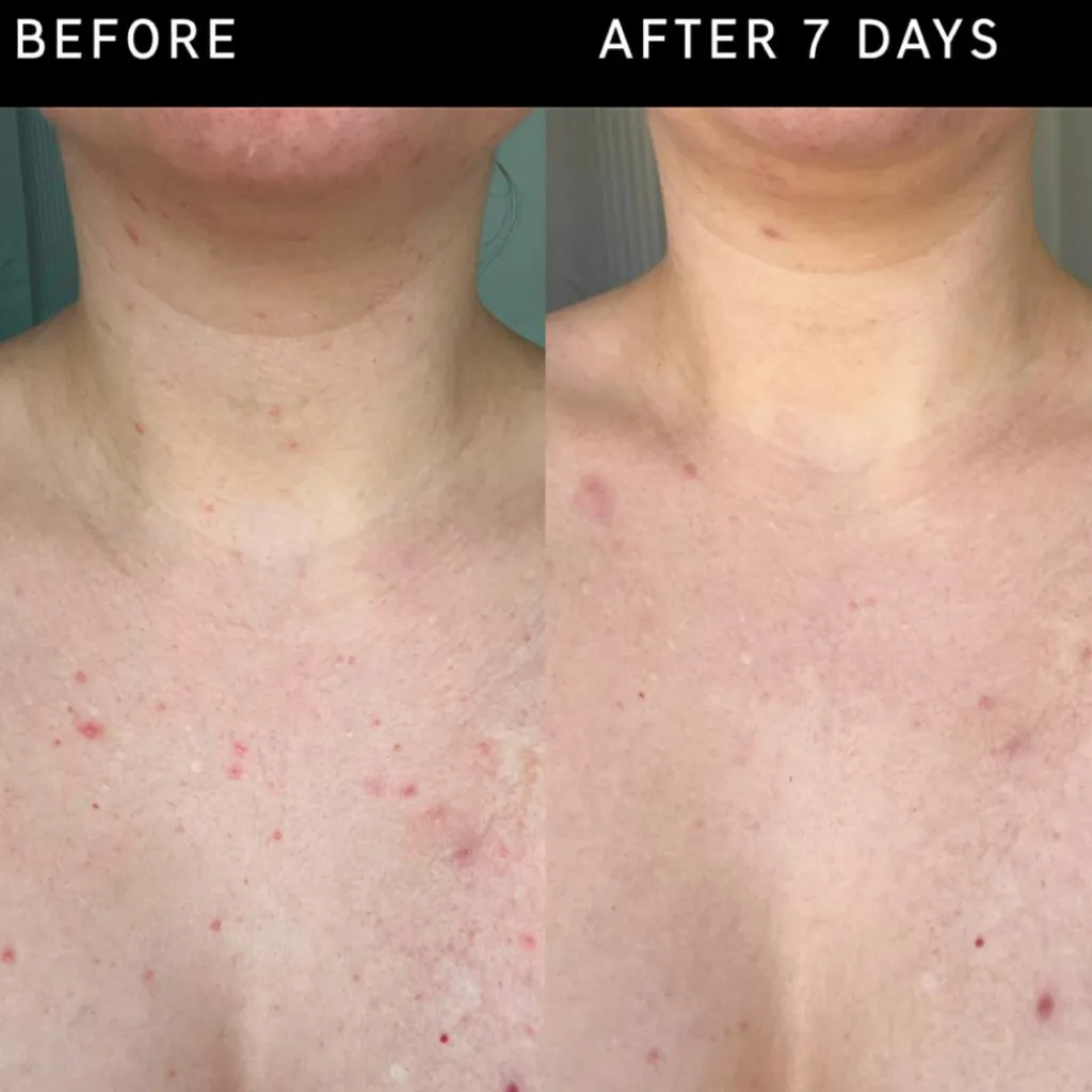 The INKEY List Scrub & Exfoliering<Glycolic Acid Exfoliating Body Stick