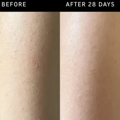 The INKEY List Scrub & Exfoliering<Glycolic Acid Exfoliating Body Stick