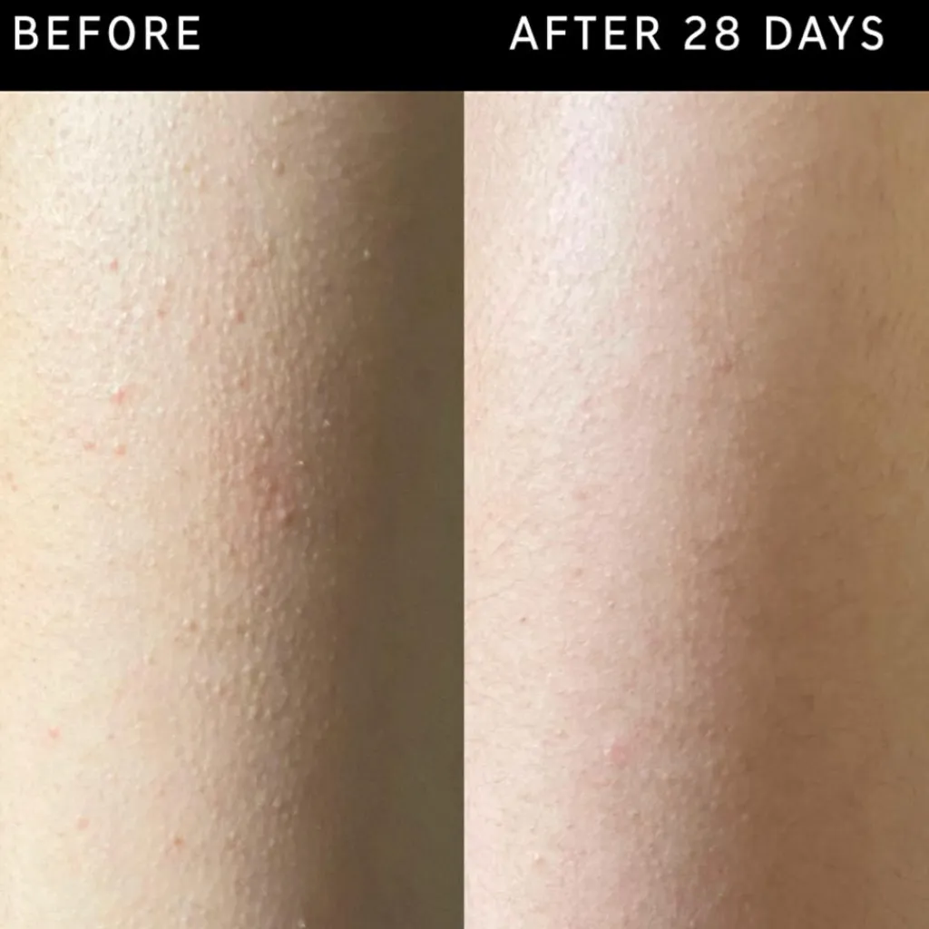 The INKEY List Scrub & Exfoliering<Glycolic Acid Exfoliating Body Stick