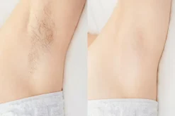 HEVI Sugaring HEVI Bodysugaring< Voks & Strips