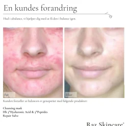 RAZ Skincare Serum><noscript><img width=