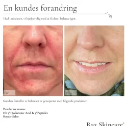 RAZ Skincare Serum><noscript><img width=