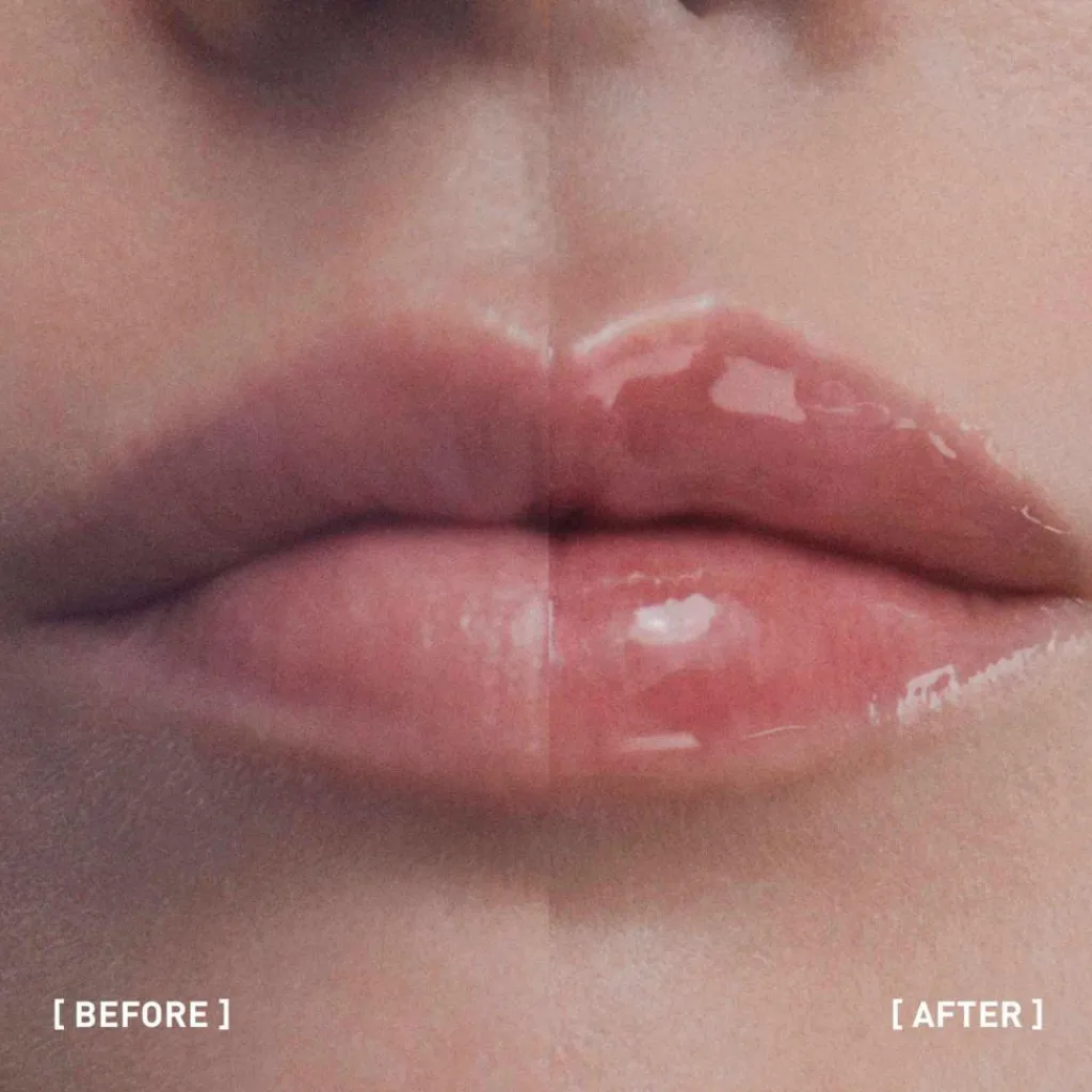 Filorga Hyalu-Filler Lips< Læbepleje