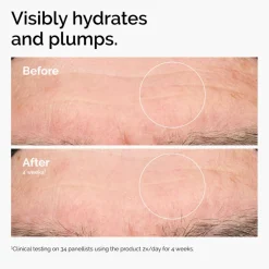 The Ordinary Hyaluronic Acid 2% + B5 Serum< Rejsestørrelser