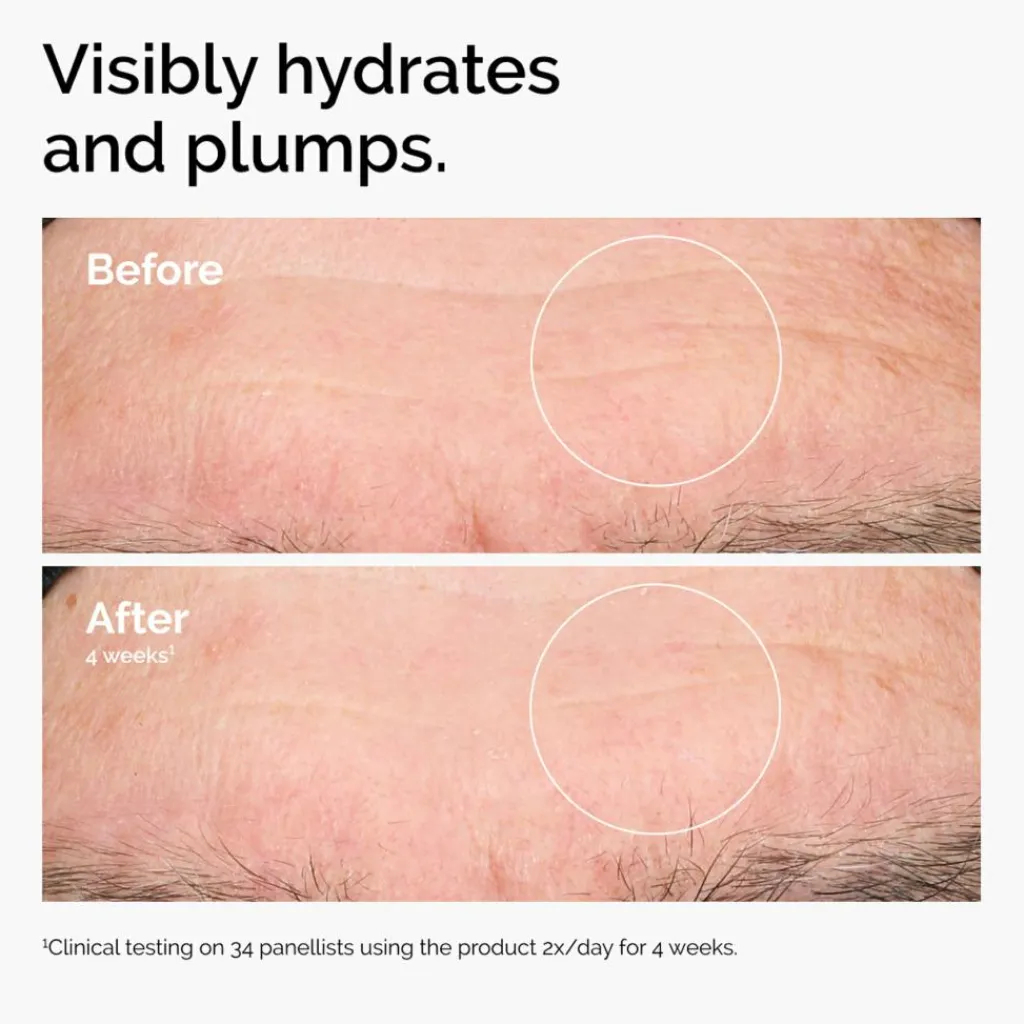 The Ordinary Hyaluronic Acid 2% + B5 Serum< Rejsestørrelser