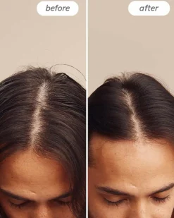 Hairlust Instant Relief™ Scalp Spray< Hovedbundspleje