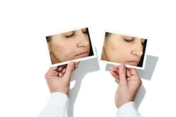 Murad Problemhud><noscript><img width=