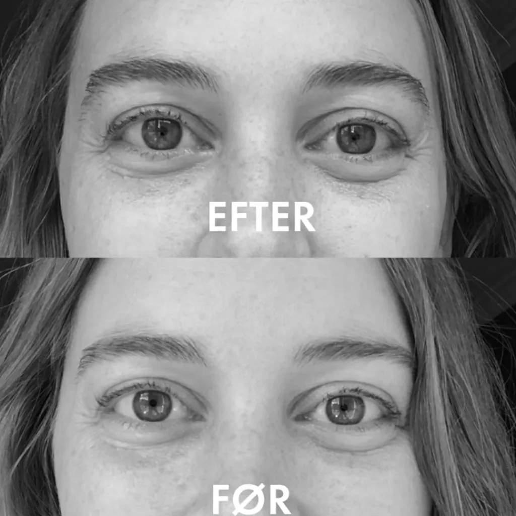Naturligolie Øjenbryn|Øjenvipper<Økologisk Bryn- & Vippeserum