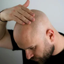 Better Be Bold Magic Bald Head & Beard Oil< Skægolie