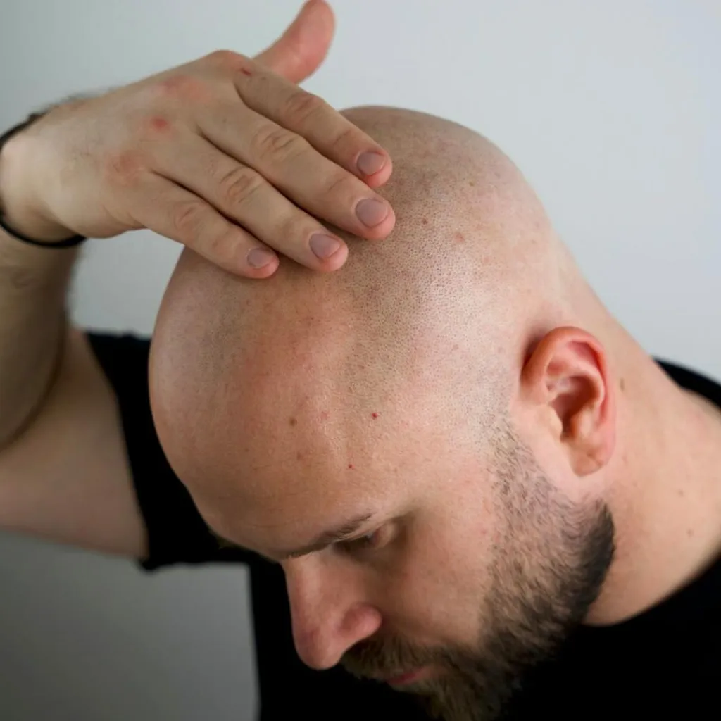 Better Be Bold Magic Bald Head & Beard Oil< Skægolie