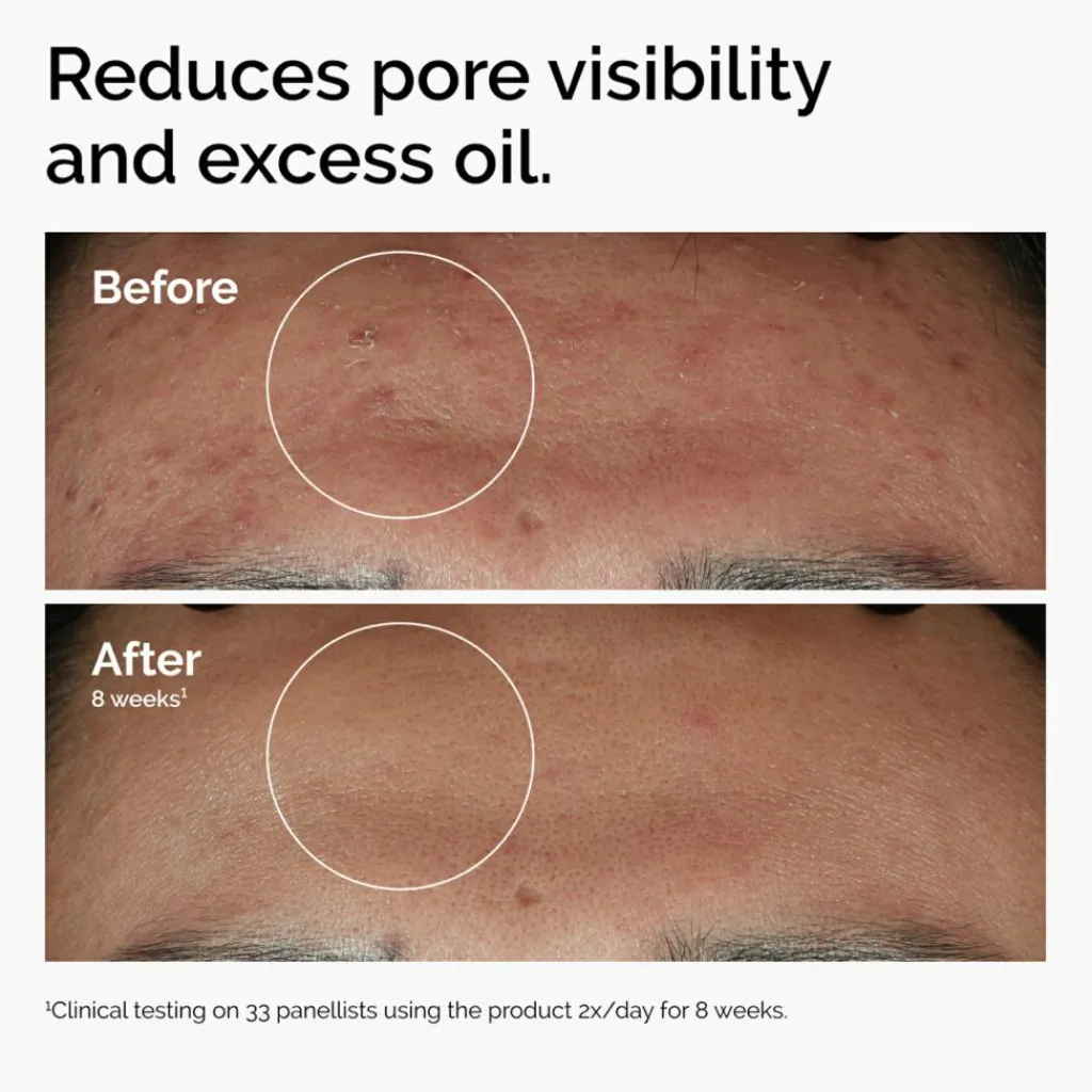 The Ordinary Serum<Niacinamide 10% + Zinc 1%