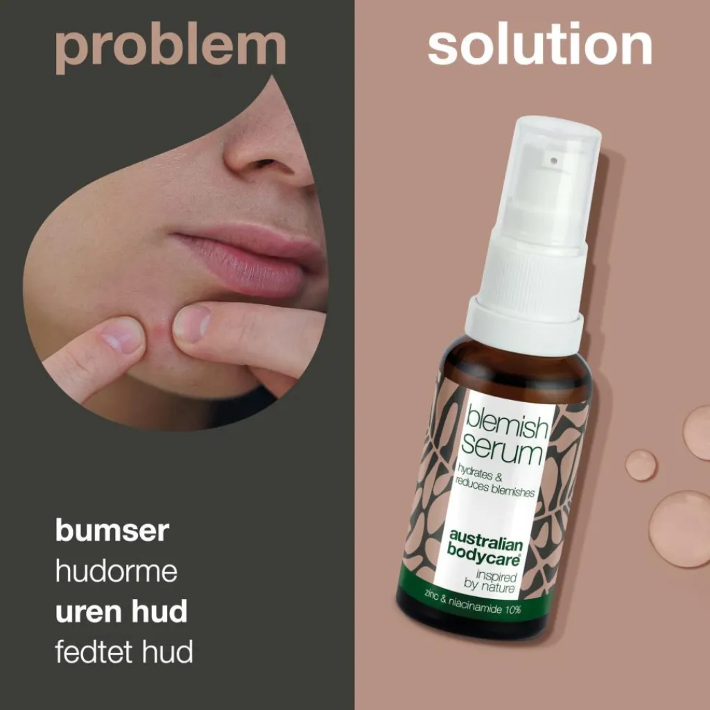 Australian Bodycare Serum<Niacinamide Blemish Serum