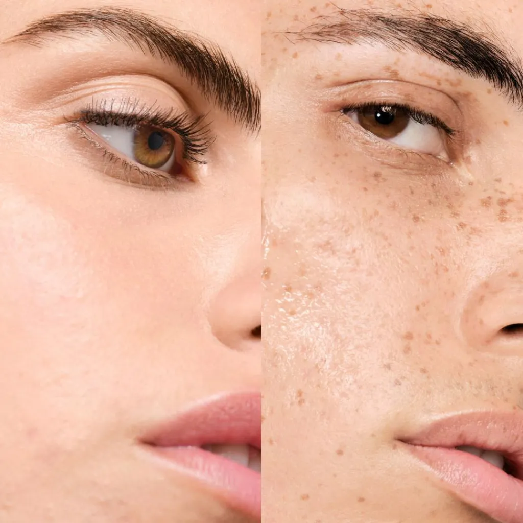 Vichy Normaderm Skintonic< Ansigtspleje|Ansigtspleje