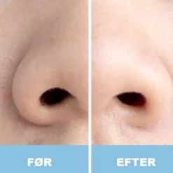 UNIQ Nose Wax Stick< Voks & Strips