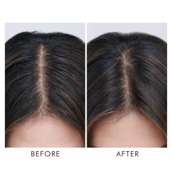 Moroccanoil Oily Scalp Treatment< Hovedbundspleje|Rejsestørrelser