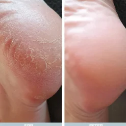 Australian Bodycare Fodpleje><noscript><img width=