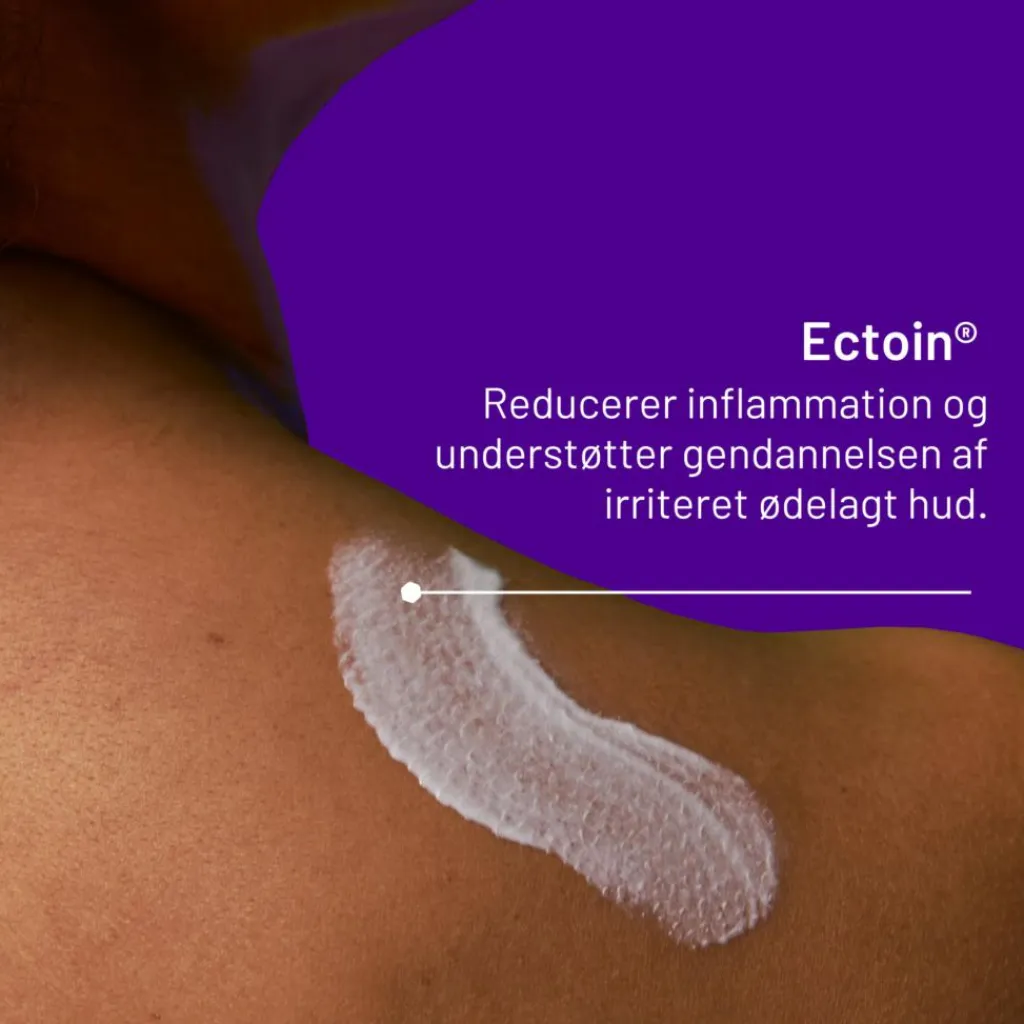 Locobase Eksem & Tør Hud<Psoriasis Cream