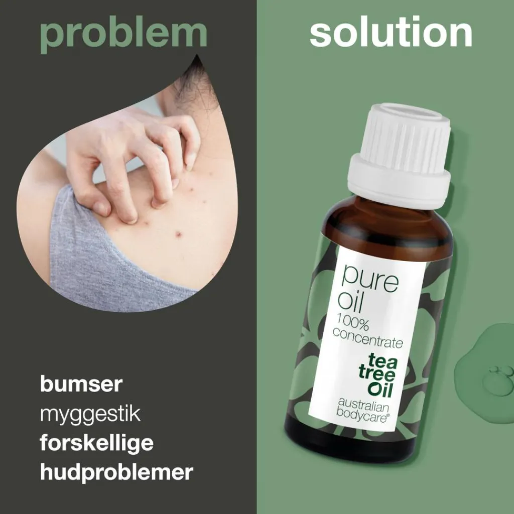 Australian Bodycare Pure Oil< Bodylotion|Problemhud