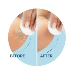 Scholl Fodpleje<Refill Velvet Smooth Eksfolierende