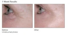 Murad Øjenpleje>Renewing Eye Cream