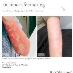 RAZ Skincare Bodylotion><noscript><img width=