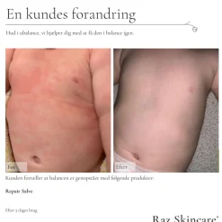 RAZ Skincare Bodylotion><noscript><img width=