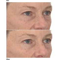 Murad Retinol Youth Renewal Eye Masks< Masker