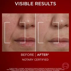 L'Oréal Paris Revitalift Laser Day Cream for Normal Skin< Anti-Age|Dagcreme