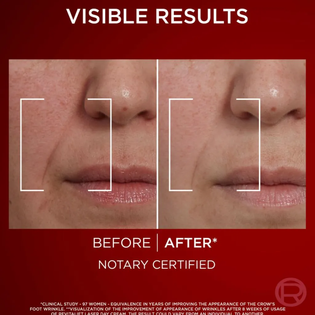 L'Oréal Paris Revitalift Laser Day Cream for Normal Skin< Anti-Age|Dagcreme