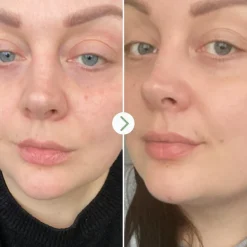 Pai Skincare Rosehip Bioregenerate< Ansigtsolie