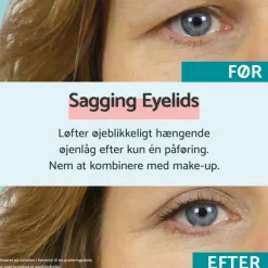 Remescar Sagging Eyelids< Øjenpleje