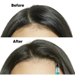 L'Oréal Professionnel Hovedbundspleje><noscript><img width=