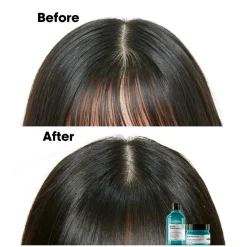 L'Oréal Professionnel Hovedbundspleje><noscript><img width=